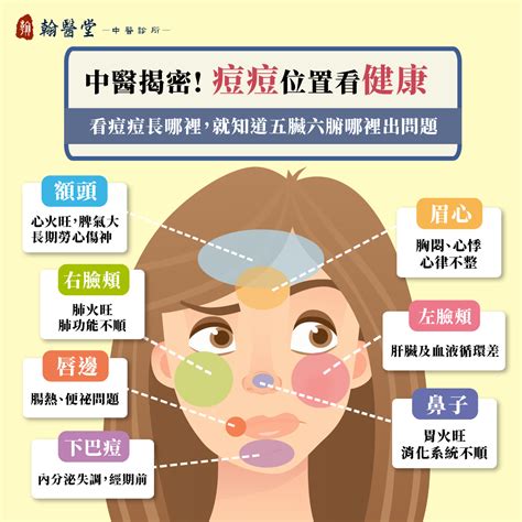 眼皮長痘痘面相|臉上痘痘影響運勢 8部位對應不同危機